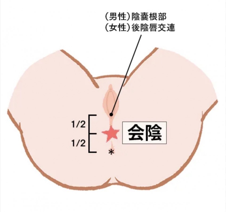 アップロード画像